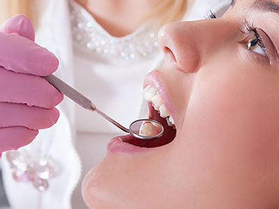 Apple Dentistry | Teeth Whitening, Extractions and Crowns  amp  Caps