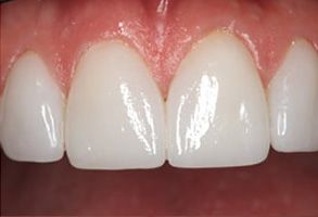 Apple Dentistry | Teeth Whitening, Sedation Dentistry and Preventative Program