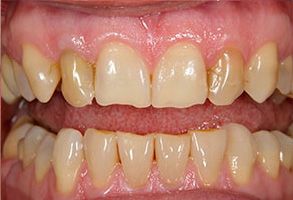 Apple Dentistry | Invisalign reg , Root Canals and Oral Exams